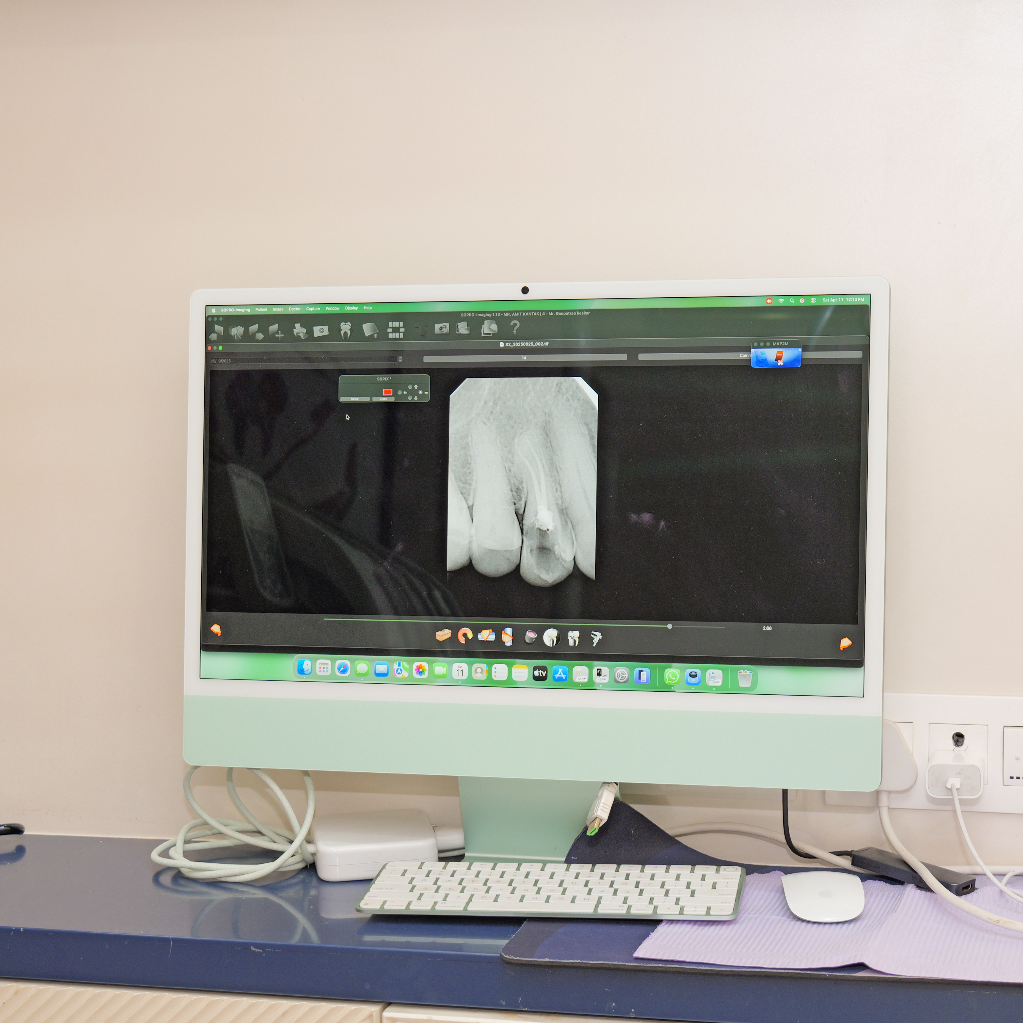 Digital RVG X-ray machine in Powai Mumbai for instant low radiation dental diagnosis